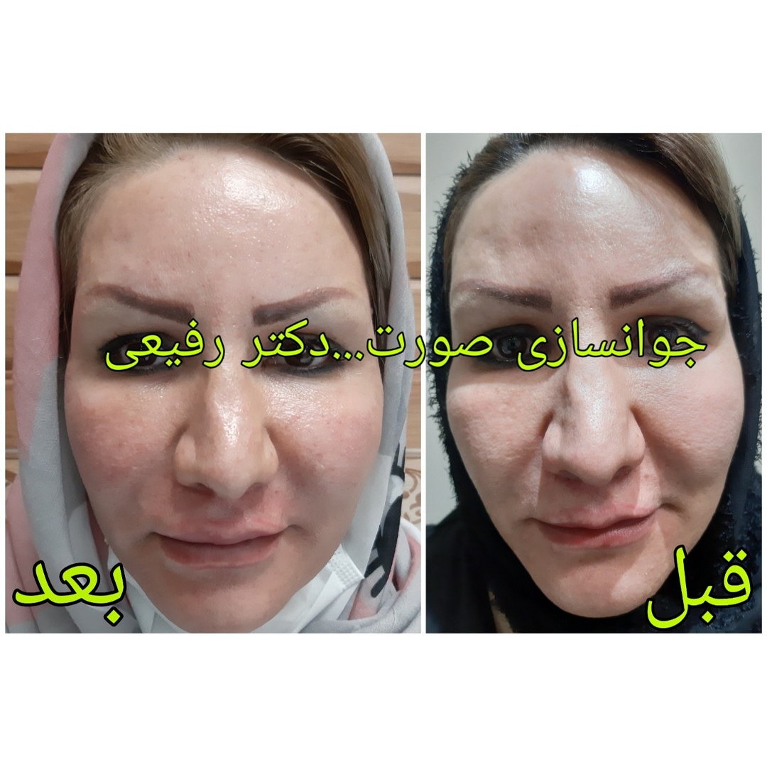  طب20 | سیستم جامع سلامت و درمان  گالری تصاویر کلینیک دکتراسماعیل  رفیعی