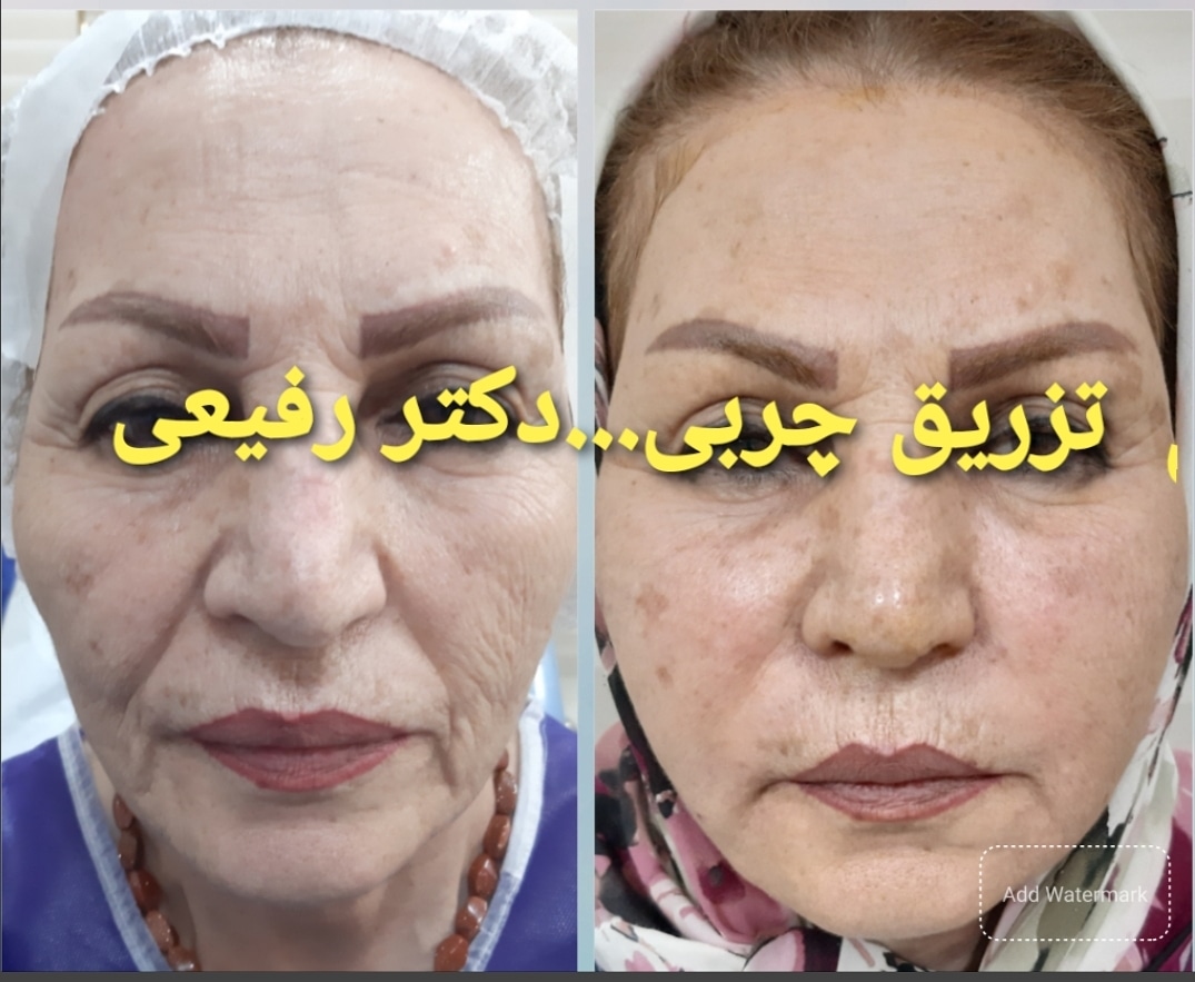  طب20 | سیستم جامع سلامت و درمان  گالری تصاویر کلینیک دکتراسماعیل  رفیعی