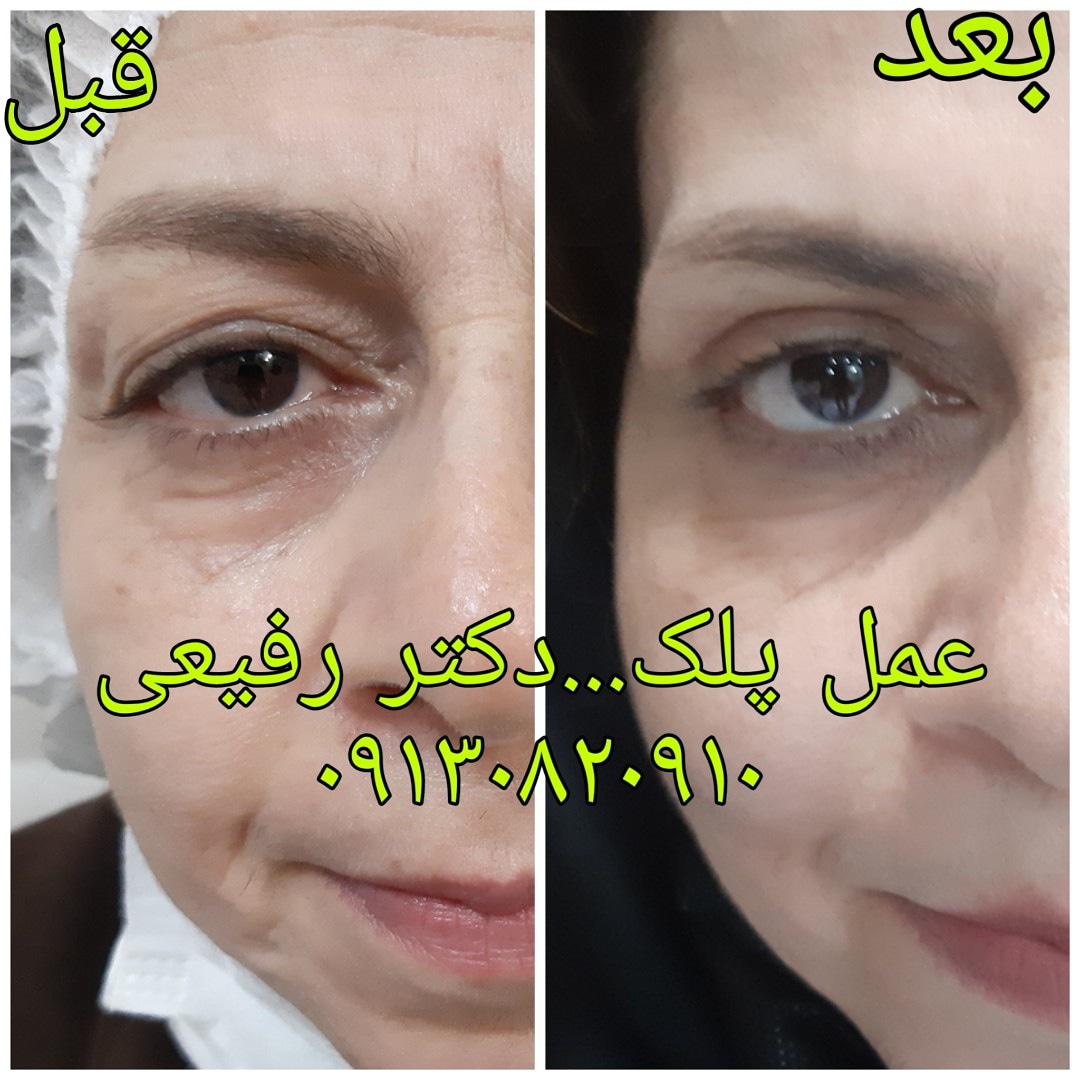  طب20 | سیستم جامع سلامت و درمان  گالری تصاویر کلینیک دکتراسماعیل  رفیعی